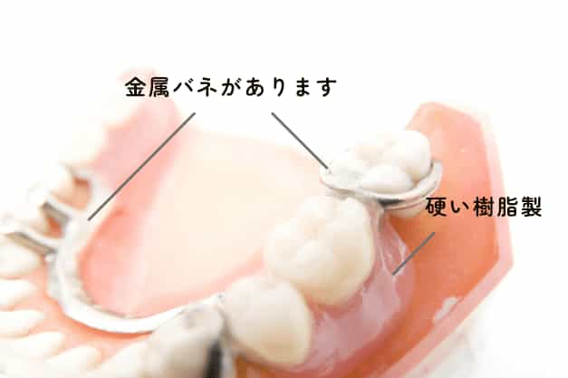 通常の入れ歯